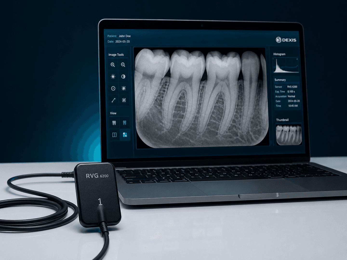 Intraoral Scanner