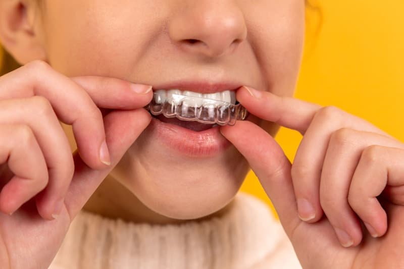 Removable Dentures