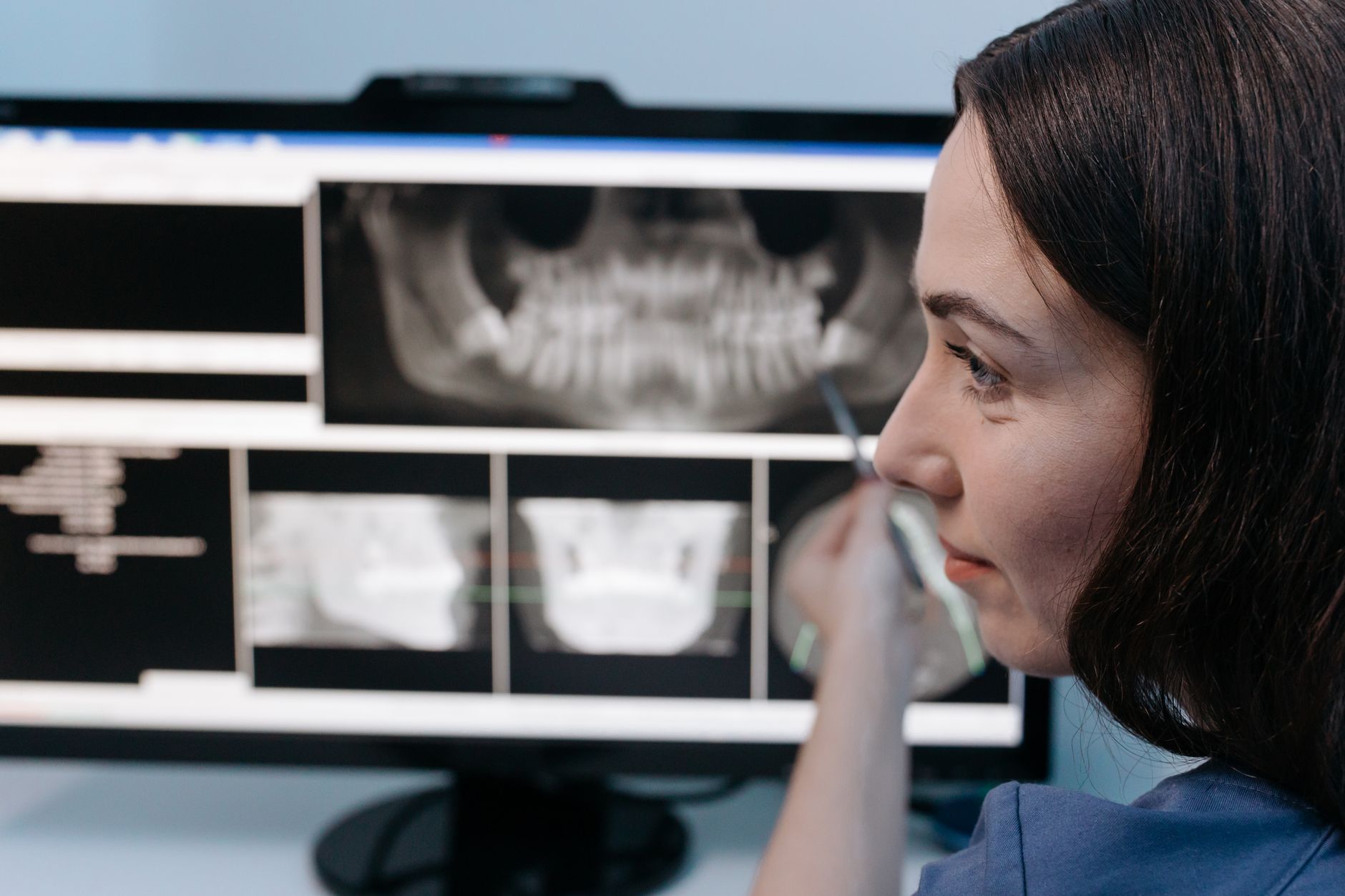 3D CBCT scan analyzing bone density and maxillary sinus anatomy in Visakhapatnam