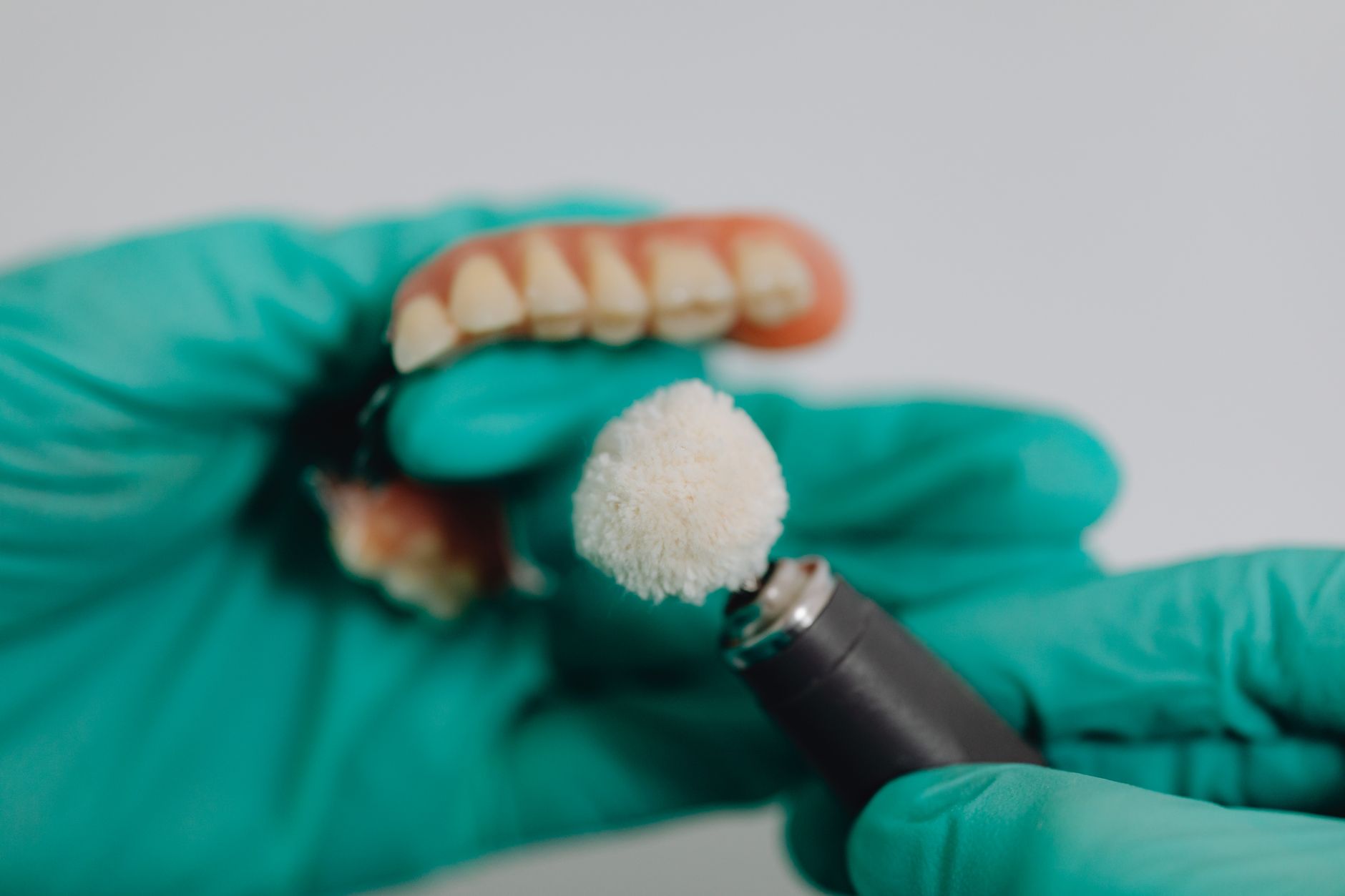Fixed full-arch zirconia implant restoration delivered to patient in Visakhapatnam